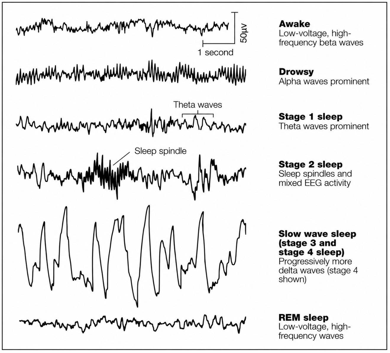 EEG patterns in sleep and wakefulness