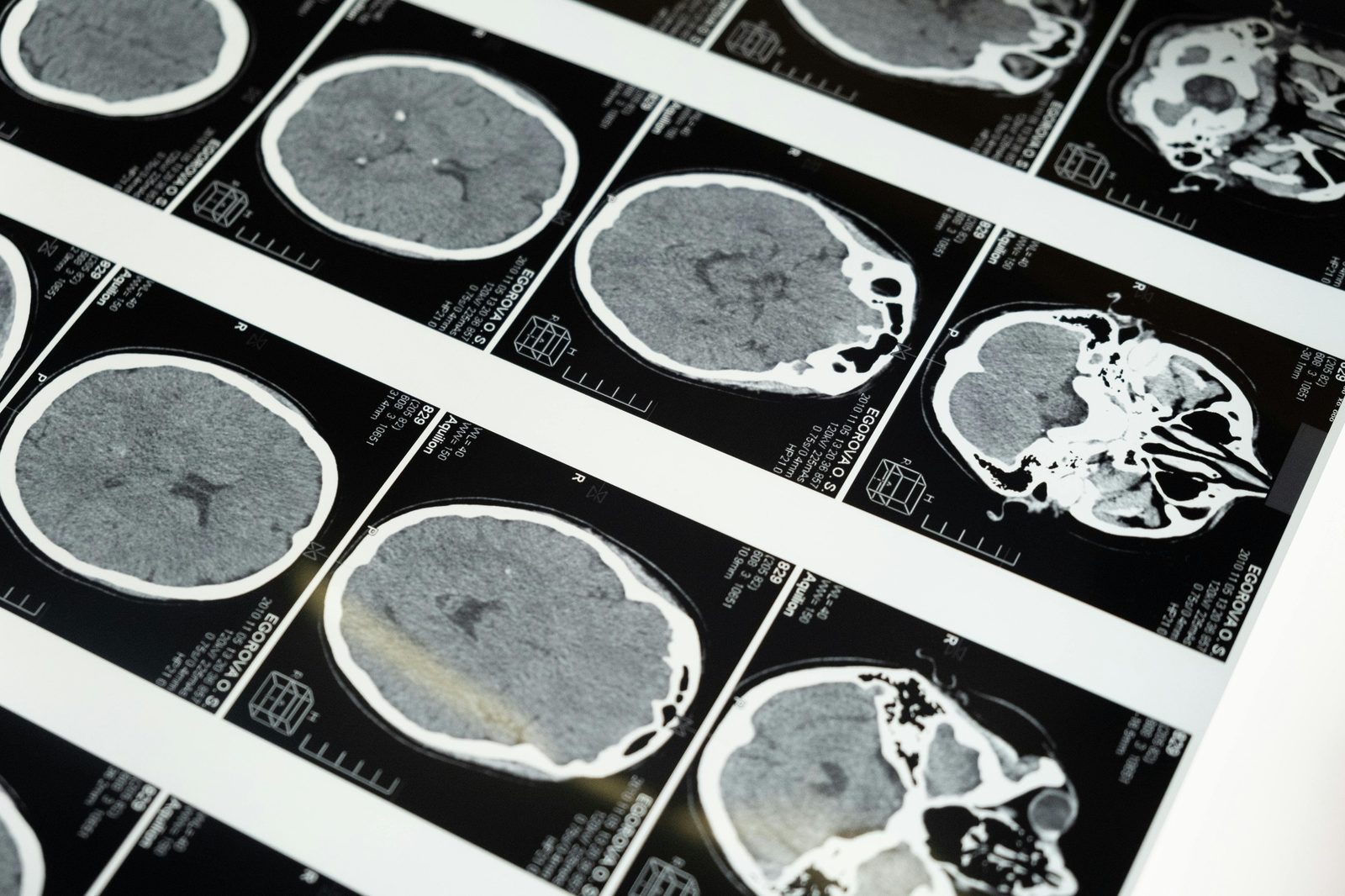 Free Will and the Brain: Who Decides First?