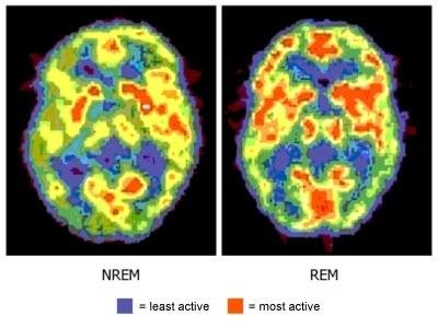 Brain activity in NREM vs REM sleep