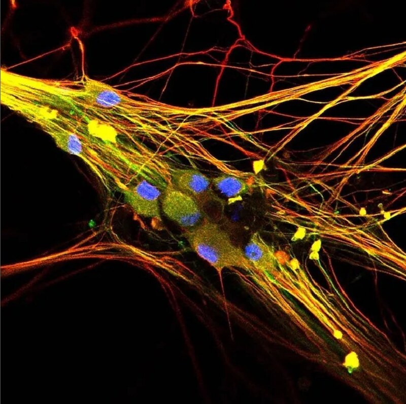 Image shows neurons connecting. Header image.